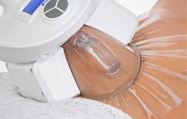 Comment perdre la graisse rebelle ?