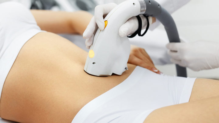 Épilation au laser : ce qu’il faut savoir avant de se lancer 