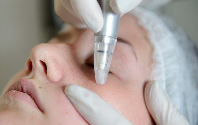 La microdermabrasion : un soin contre les imperfections de la peau