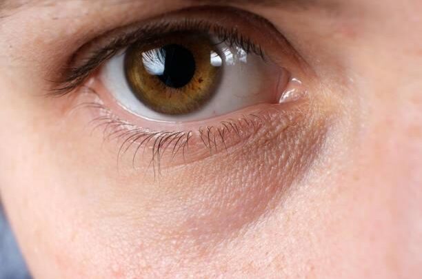 DIY : une recette de soin contour des yeux naturel et décongestionnant