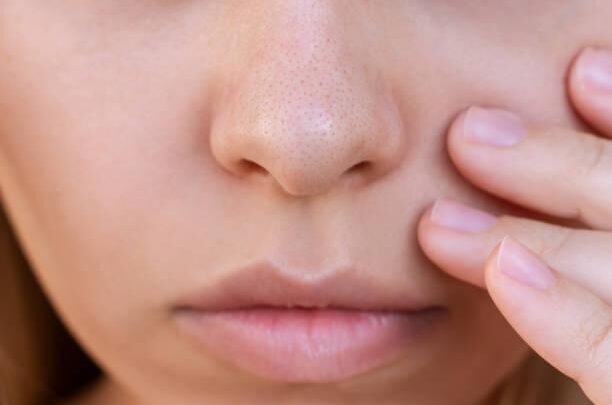 La routine idéale pour se débarrasser durablement des points noirs sur le nez